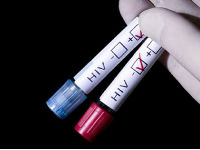 625751_hiv-test-660x350-1454068683jpg